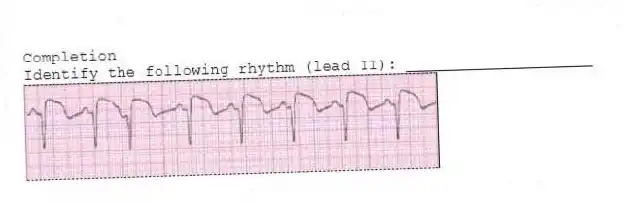 Completion
-Identify the following rhythm (lead II): ____________________