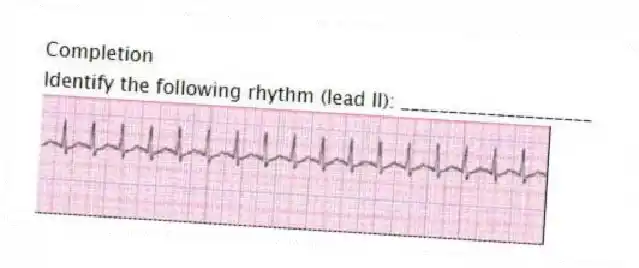 Completion
-Identify the following rhythm (lead II): ____________________
 