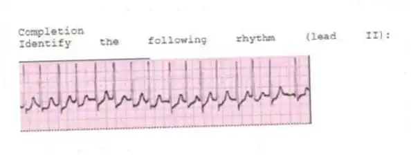 Completion
-Identify the following rhythm (lead II): ____________________