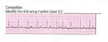Completion
-Identify the following rhythm (lead II): ____________________