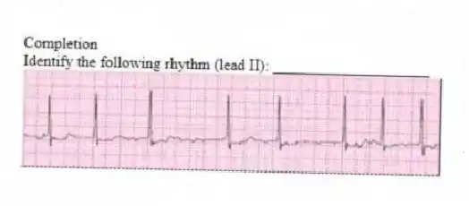 Completion
-Identify the following rhythm (lead II): ____________________