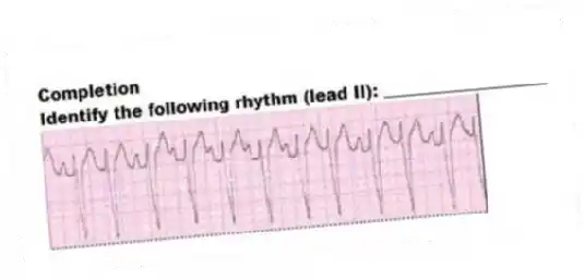 Completion
-Identify the following rhythm (lead II): ____________________