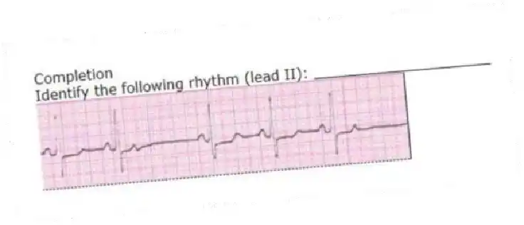 Completion
-Identify the following rhythm (lead II): ____________________