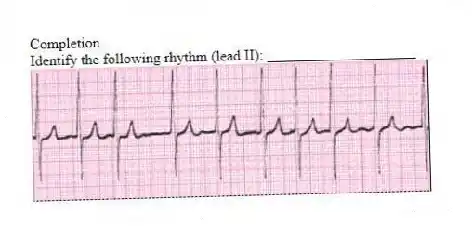 Completion
-Identify the following rhythm (lead II): ____________________