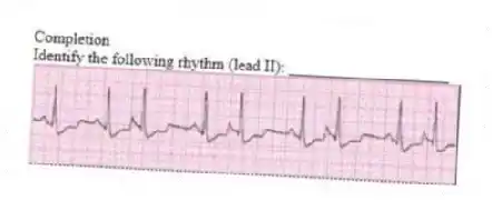 Completion
-Identify the following rhythm (lead II): ____________________