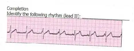 Completion
-Identify the following rhythm (lead II): ____________________