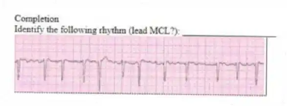 Completion
-Identify the following rhythm (lead MCL?): ____________________