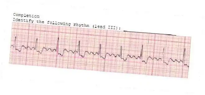 Completion
-Identify the following rhythm (lead III): ____________________
 