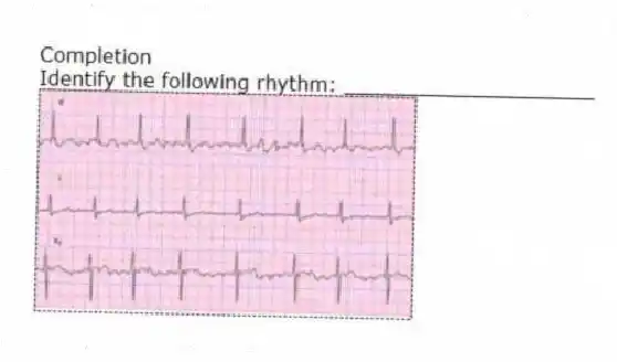 Completion
-Identify the following rhythm: ____________________