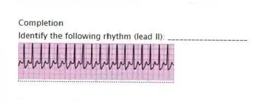 Completion
-Identify the following rhythm (lead II): ____________________