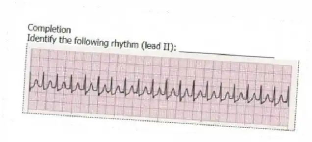 Completion
-Identify the following rhythm (lead II): ____________________