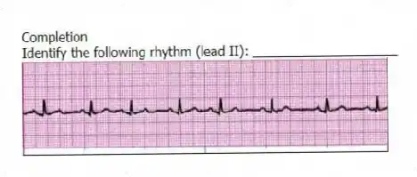Completion
-Identify the following rhythm (lead II): ____________________