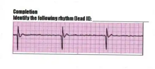 Completion
-Identify the following rhythm (lead II): ____________________