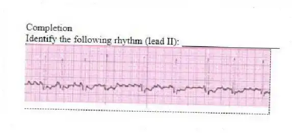 Completion
-Identify the following rhythm (lead II): ____________________
 