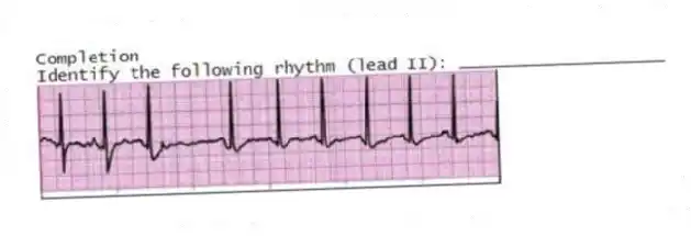 Completion
-Identify the following rhythm (lead II): ____________________