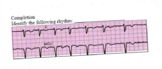 Completion
-Identify the following rhythm: ____________________