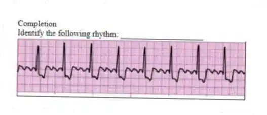 Completion
-Identify the following rhythm: ____________________