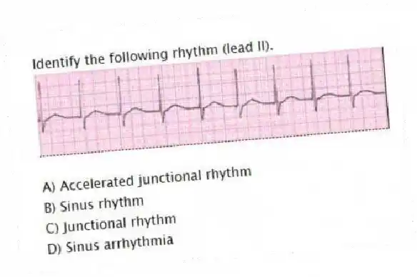 Identify the following rhythm (lead II).
A) Accelerated junctional rhythm
B) Sinus rhythm
C) Junctional rhythm
D) Sinus arrhythmia
