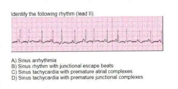 Identify the following rhythm (lead II).
A) Sinus arrhythmia
B) Sinus rhythm with junctional escape beats
C) Sinus tachycardia with premature atrial complexes
D) Sinus tachycardia with premature junctional complexes
