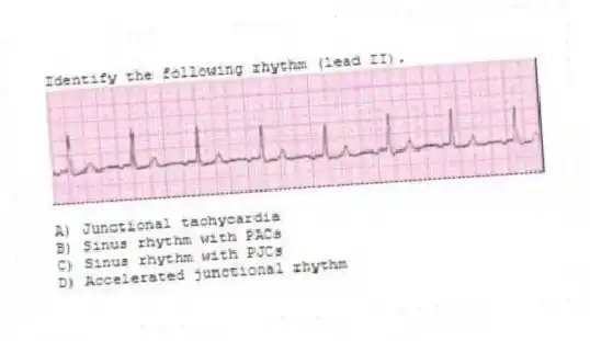 Identify the following rhythm (lead II).
A) Junctional tachycardia
B) Sinus rhythm with PACs
C) Sinus rhythm with PJCs
D) Accelerated junctional rhythm