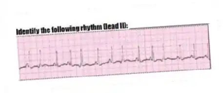 Identify the following rhythm (lead II): ____________________