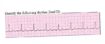 Identify the following rhythm (lead II): ____________________