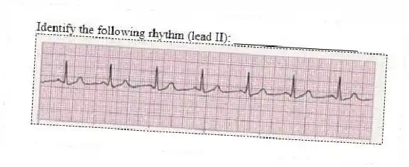Identify the following rhythm (lead II): ____________________