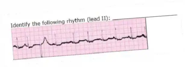 Identify the following rhythm (lead II): ____________________