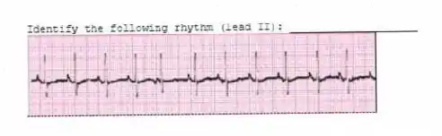 Identify the following rhythm (lead II): ____________________