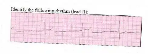 Identify the following rhythm (lead II): ____________________