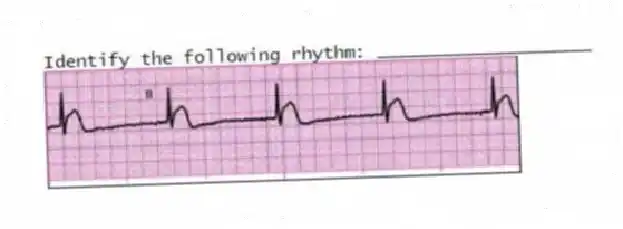 Identify the following rhythm: ____________________
