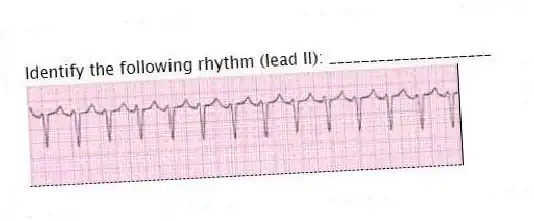 Identify the following rhythm (lead II): ____________________