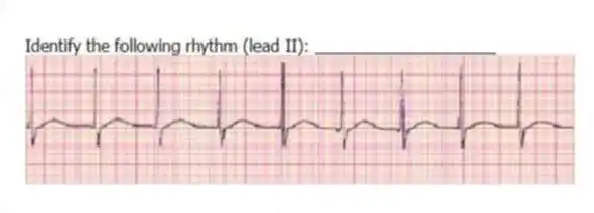 Identify the following rhythm (lead II): ____________________
 