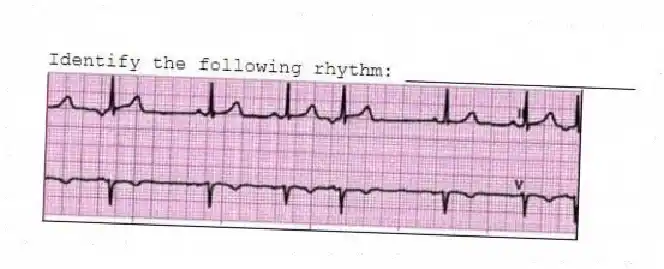 Identify the following rhythm: ____________________