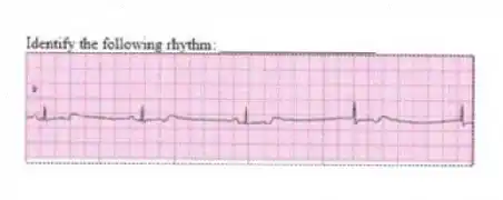 Identify the following rhythm: ____________________