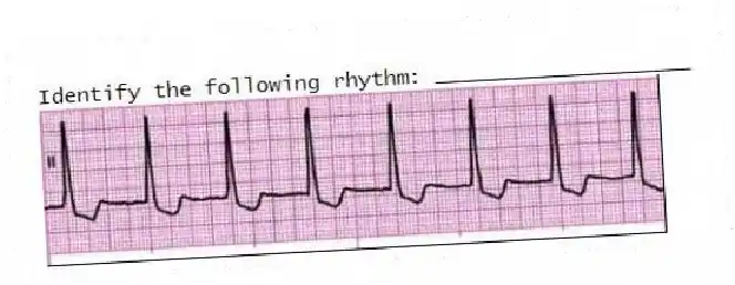 Identify the following rhythm: ____________________