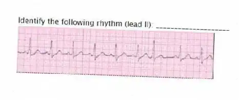Identify the following rhythm (lead II): ____________________
