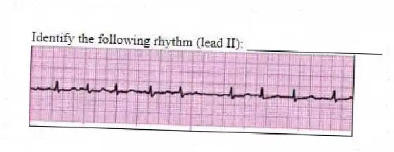 Identify the following rhythm (lead II): ____________________
 