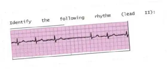 Identify the following rhythm (lead II): ____________________
 