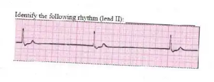 Identify the following rhythm (lead II): ____________________