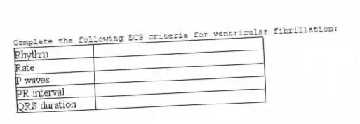 Complete the following ECG criteria for ventricular fibrillation: