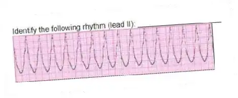 Identify the following rhythm (lead II): ____________________