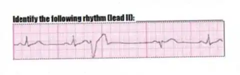 Identify the following rhythm (lead II): ____________________