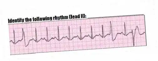 Identify the following rhythm (lead II): ____________________