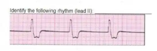 Identify the following rhythm (lead II): ____________________