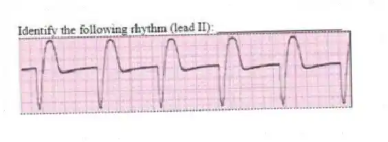 Identify the following rhythm (lead II): ____________________
 