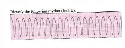 Identify the following rhythm (lead II): ____________________