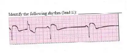Identify the following rhythm (lead II): ____________________