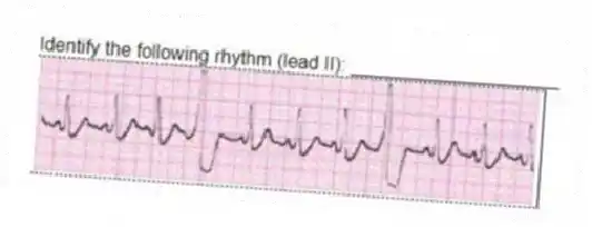 Identify the following rhythm (lead II): ____________________
