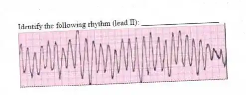 Identify the following rhythm (lead II): ____________________